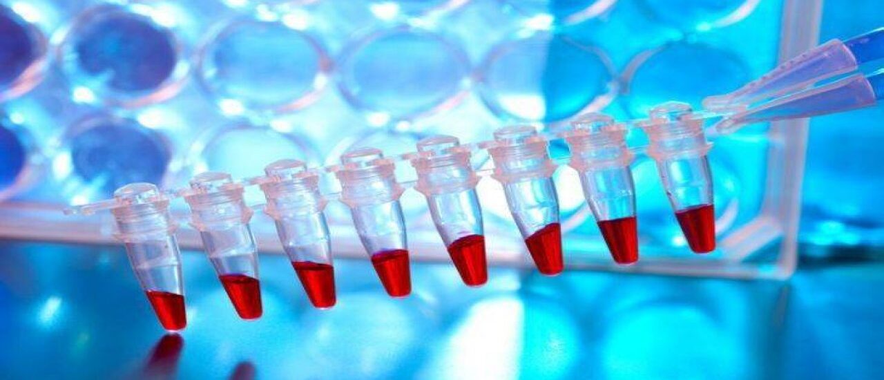 PCR Bottles Market