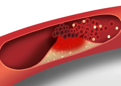 Cholesteryl Isostearate Market