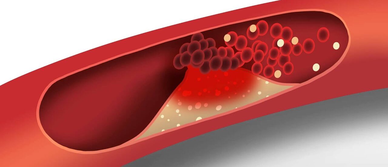 Cholesteryl Isostearate Market