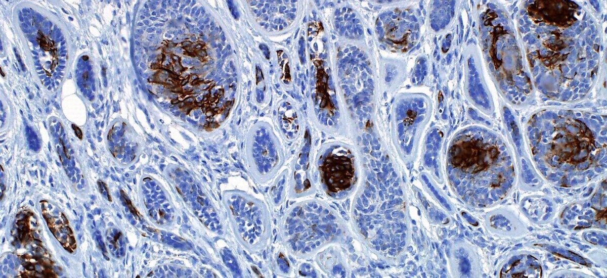 Immunohistochemistry Market