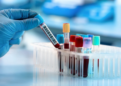 Autoimmune Disease Testing Market