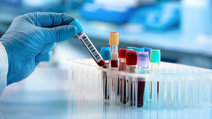 Autoimmune Disease Testing Market