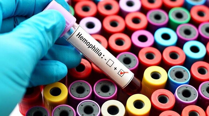 Bleeding Disorder Testing Market