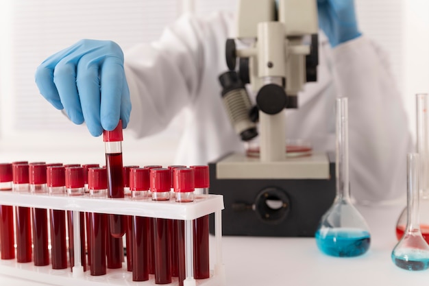 Blood Coagulation Analyzers Market