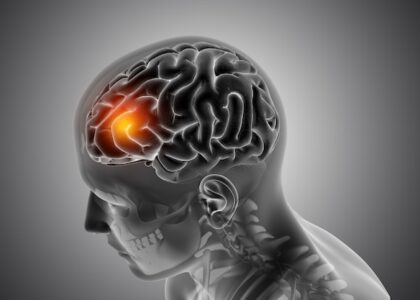 Brain Tumour Drug Market