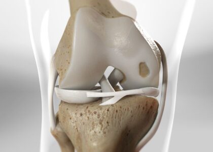 Cartilage Repair Market