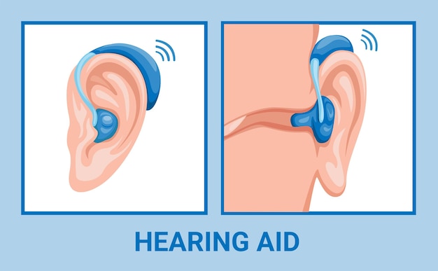 Hearing Aids Market