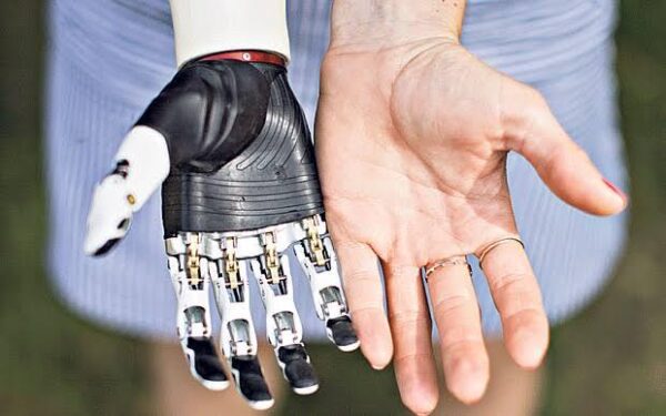 Medical Bionic Implant And Artificial Organs Market