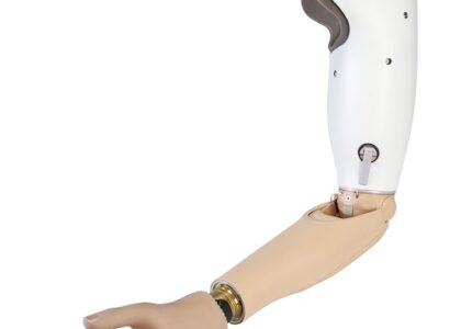 Upper Limb Prosthetics Market