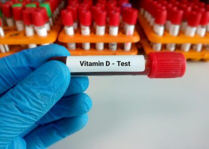 Vitamin D Testing Market