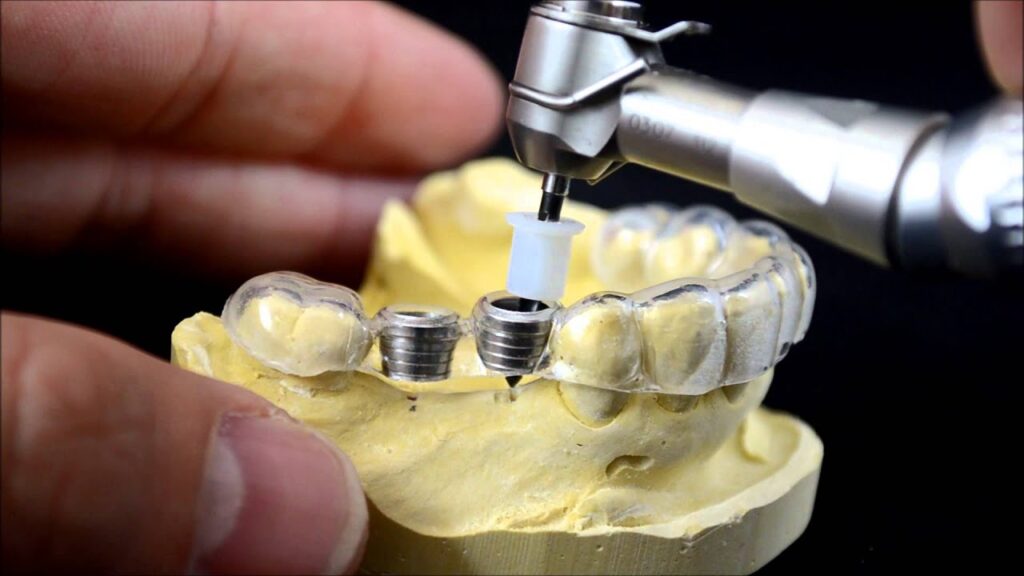 3D Printed Medical Implants Market