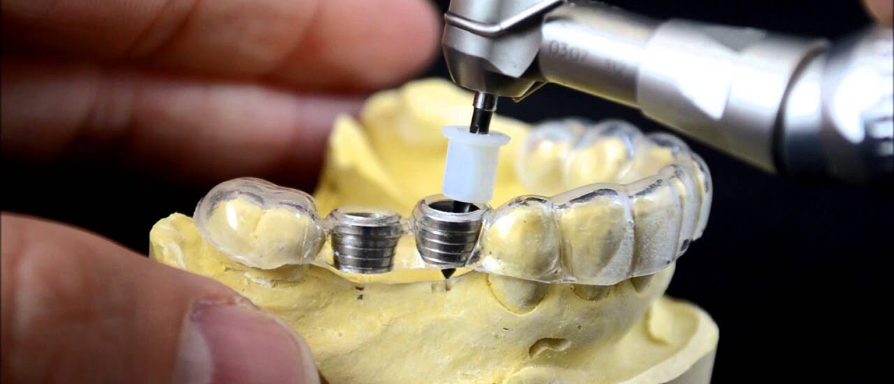 3D Printed Medical Implants Market