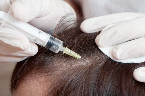 Alopecia Treatment Market