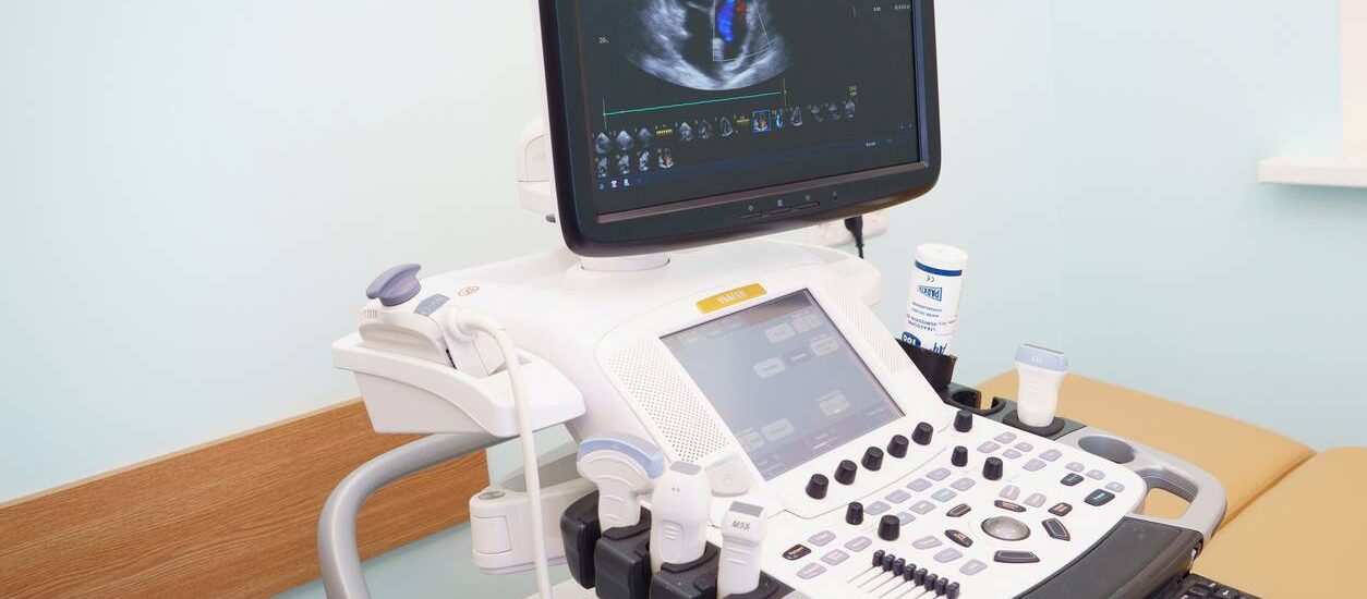 Cardiovascular Ultrasound Market