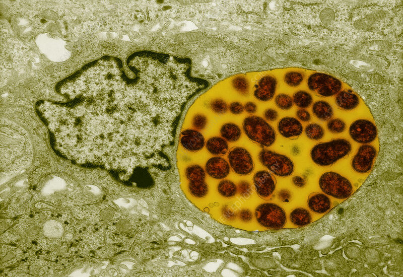 Chlamydia Diagnostics Market