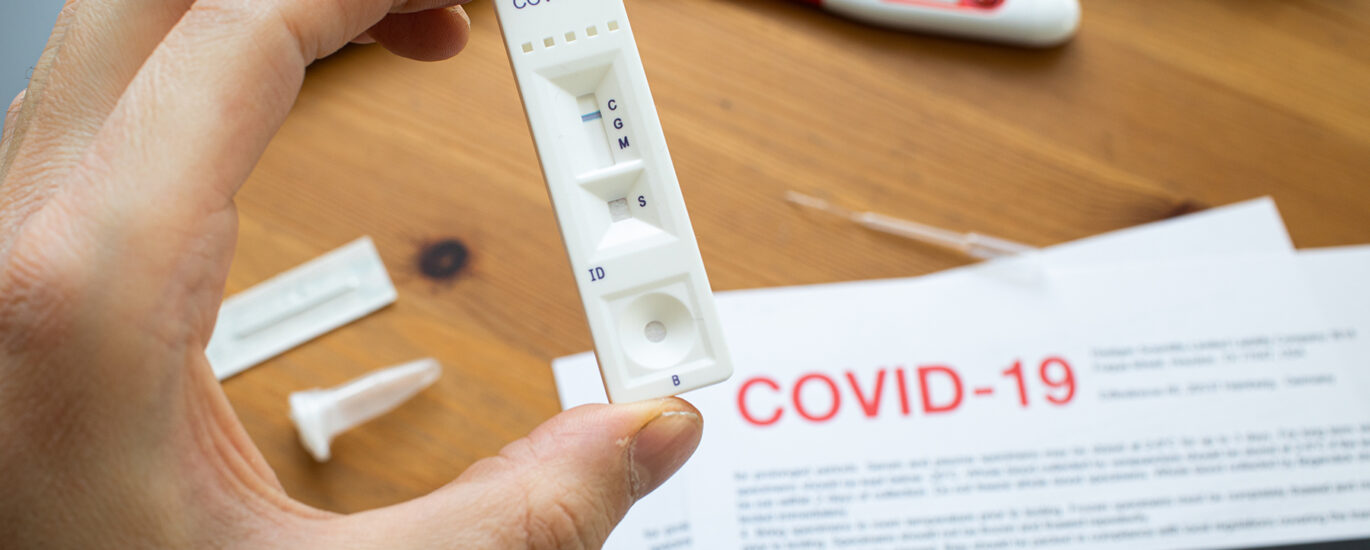 Covid-19 Diagnostics Market