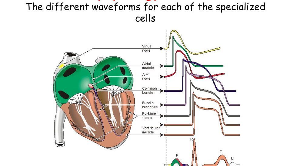 Electrophysiology Market