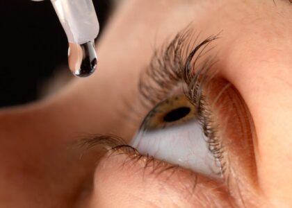 Exophthalmos Treatment Market