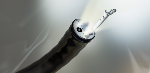 Flexible Endoscopes Market