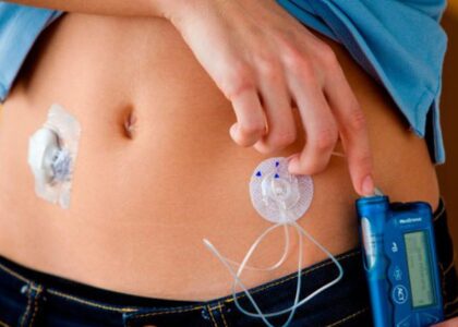 Implanted Infusion Pumps Market