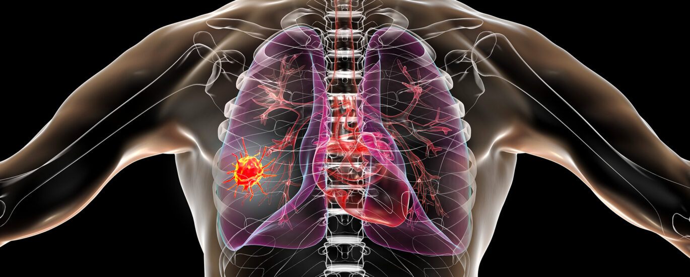 Lung Cancer PCR Panel Market