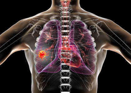 Lung Cancer PCR Panel Market