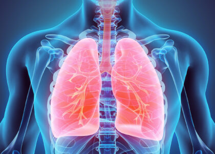 Non-Small Cell Lung Cancer Market