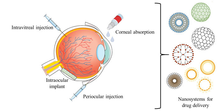 Ocular Drug Delivery System Market