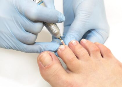 Onychomycosis Treatment Market