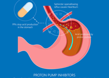 Proton Pump Inhibitors Market 