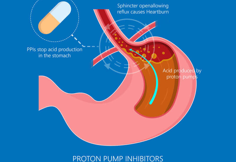 Proton Pump Inhibitors Market 