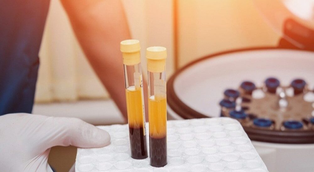 Platelet Rich Plasma Market