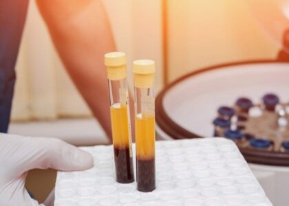 Platelet Rich Plasma Market