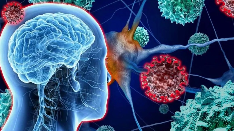 Rare Neurological Disease Treatment Market