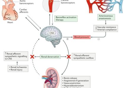 Treatment-Resistant Hypertension Management Market