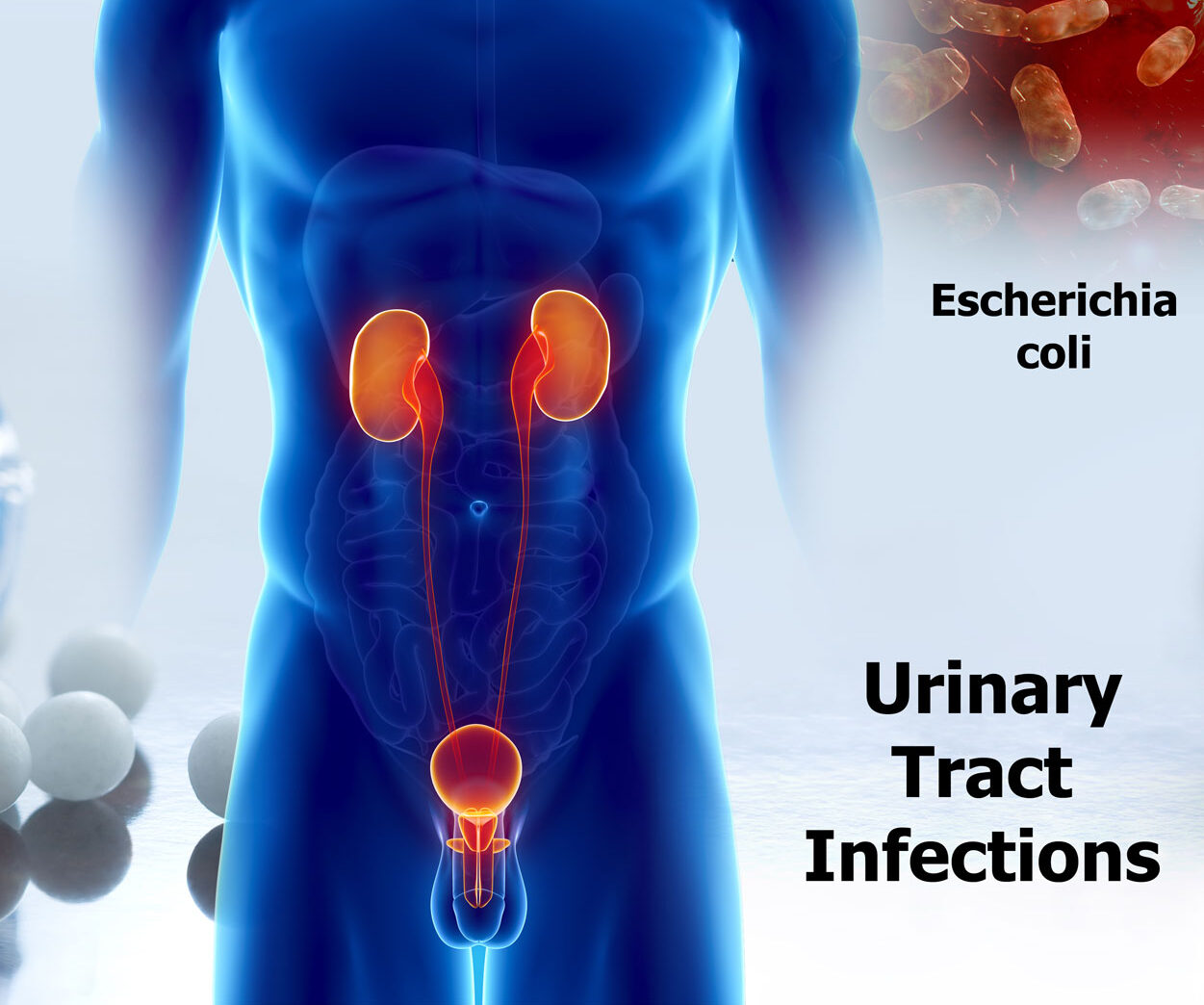 urinary-tract-infection-treatment-market-fmi