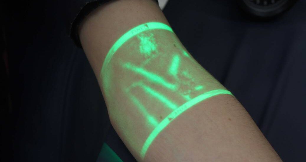 Vein Illuminator Market