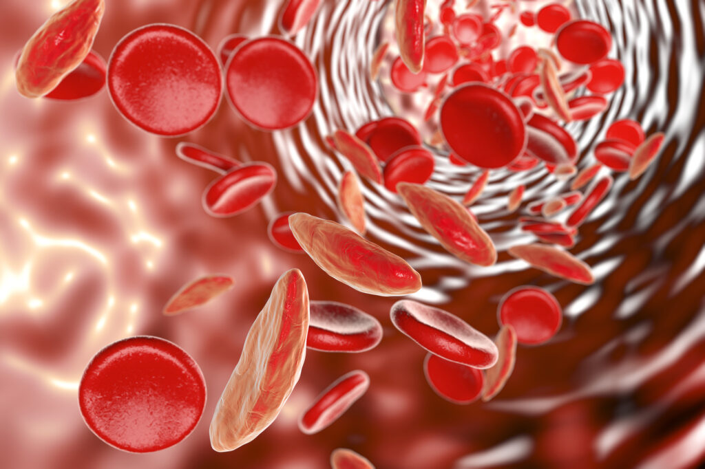 Anemia Treatment Market