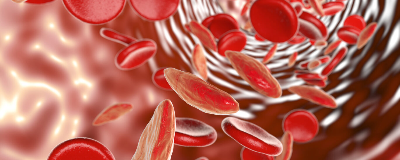 Anemia Treatment Market