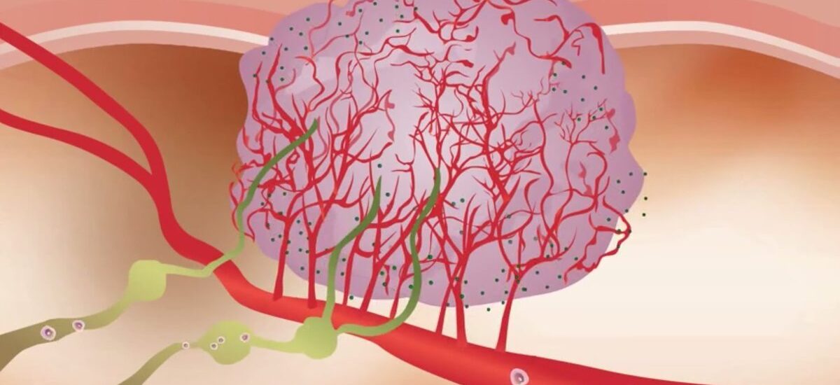 Angiogenesis Assays Market