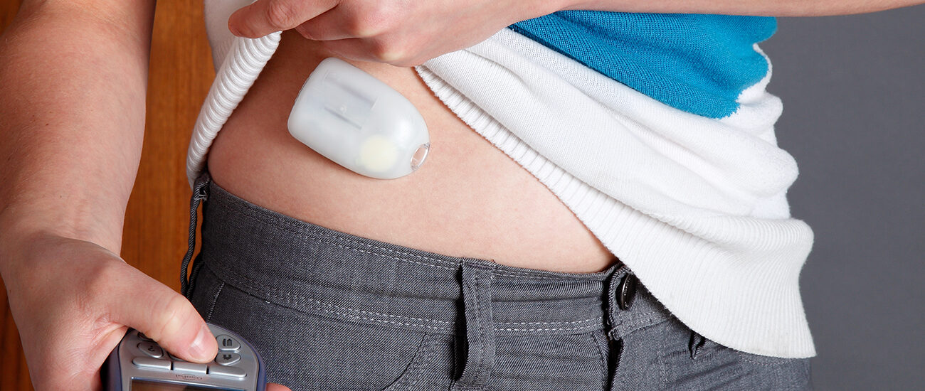 Artificial Pancreas Device Systems Market