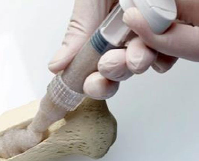 Bone Grafts and Substitutes Market