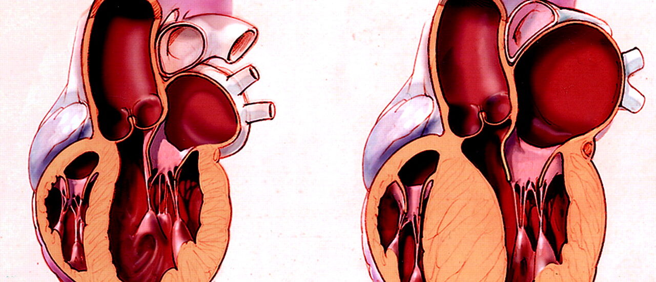 Canine Dilated Cardiomyopathy Drugs Market