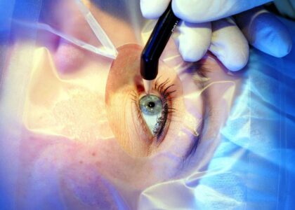 Cataract Surgery Devices Market