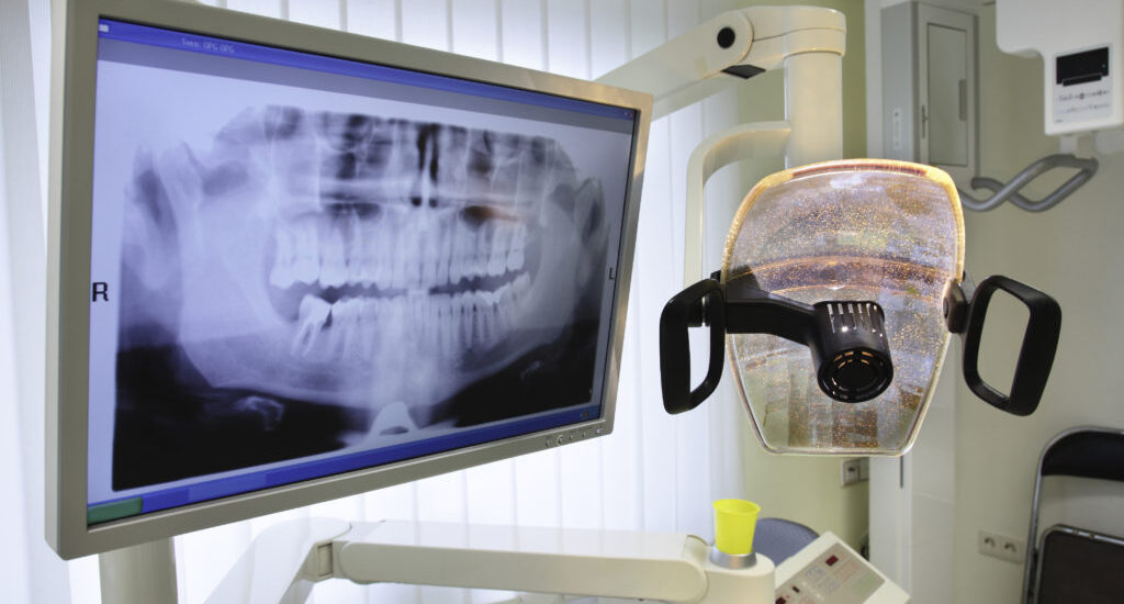 Dental X-ray Systems Market