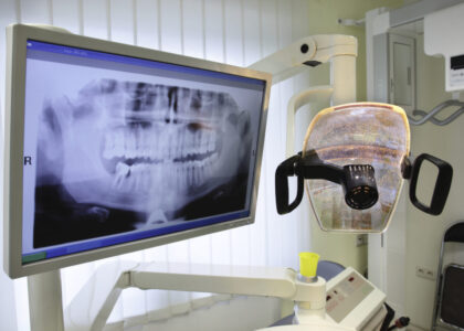 Dental X-ray Systems Market