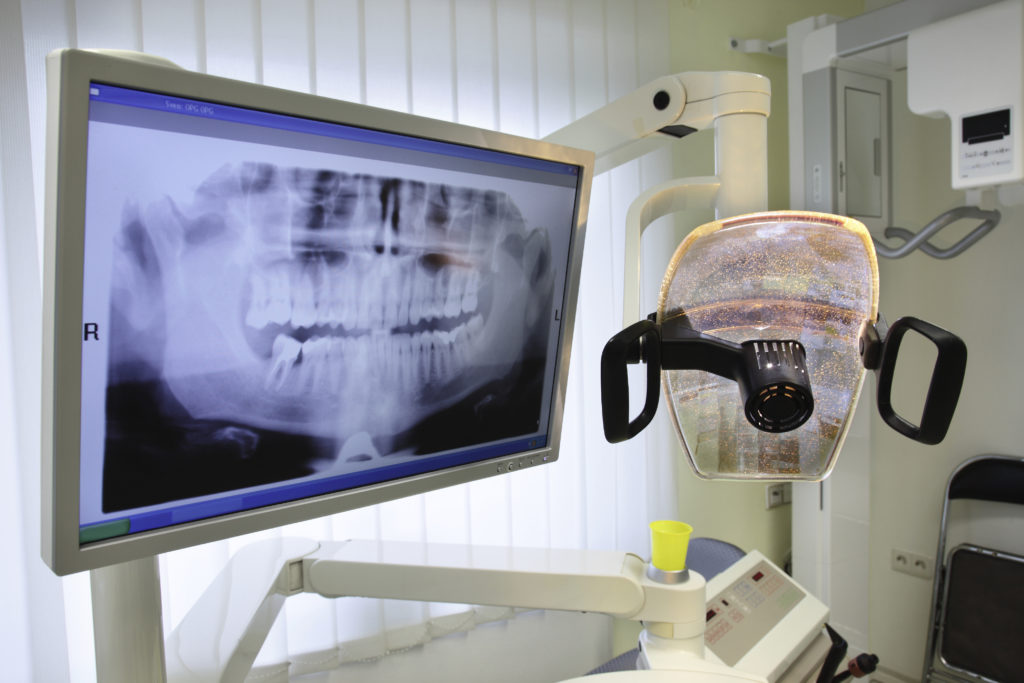 Dental X-ray Systems Market