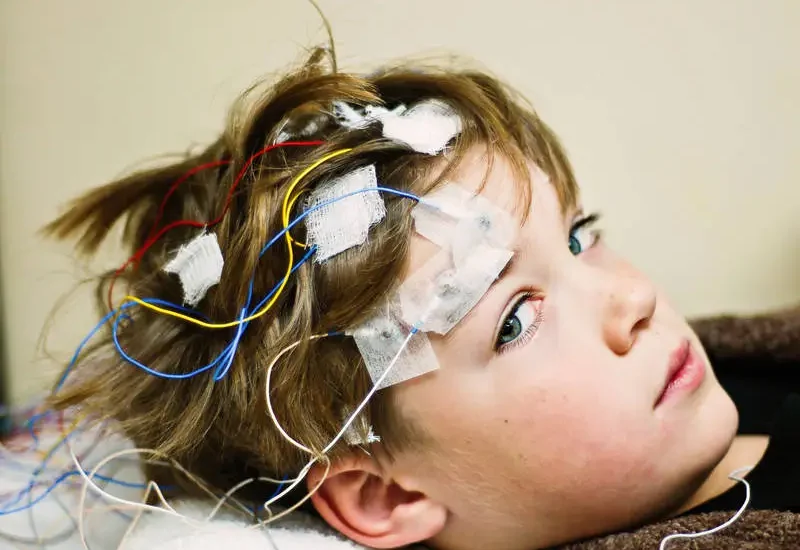 Developmental and Epileptic Encephalopathies (DEE) Treatment Market