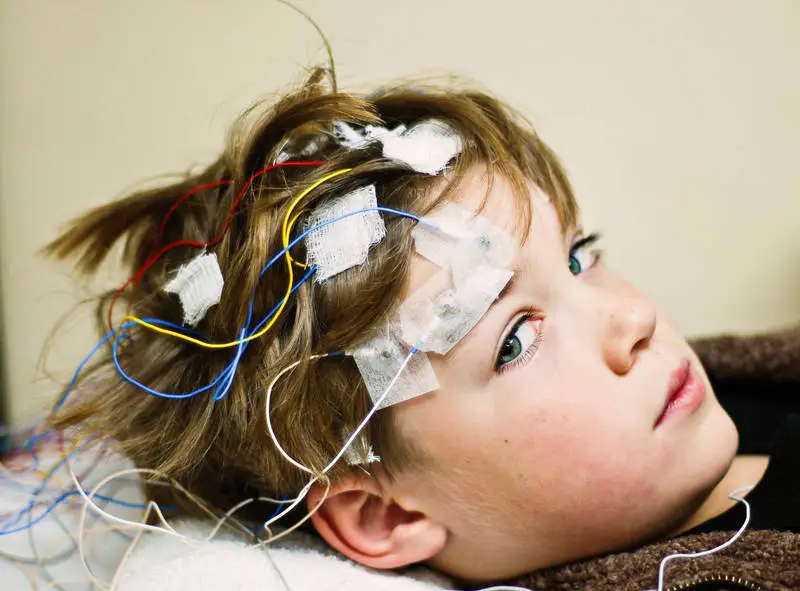 Developmental and Epileptic Encephalopathies (DEE) Treatment Market