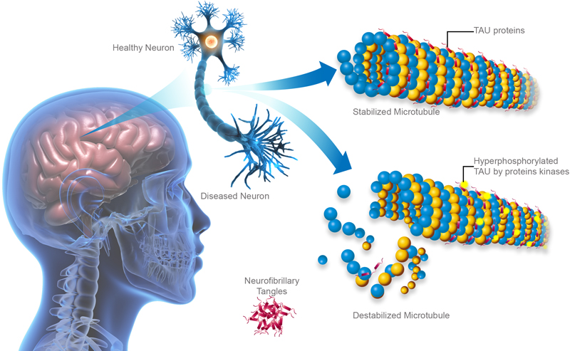 Difficult-To-Express Proteins Market